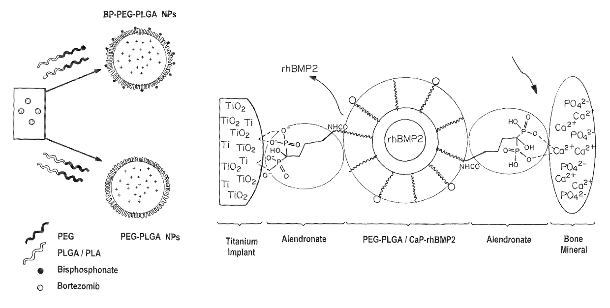 Bone and metal targeted polymeric nanoparticles