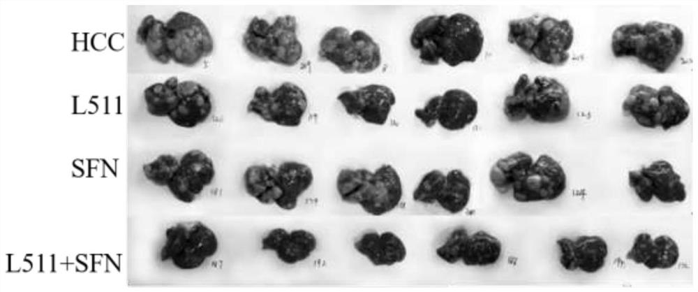 Lactobacillus paracasei L511 capable of inhibiting growth of liver cancer tumor and application of lactobacillus paracasei L511