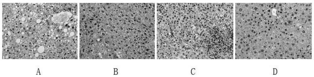 Lactobacillus paracasei L511 capable of inhibiting growth of liver cancer tumor and application of lactobacillus paracasei L511