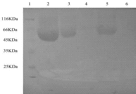 Pegylated exenatide ramification and use thereof