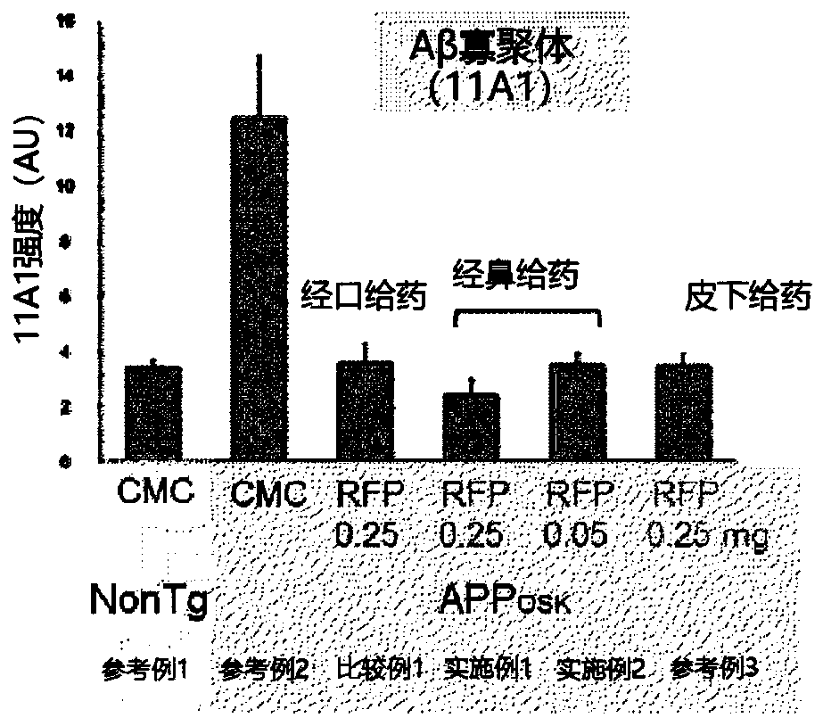 Pharmaceutical composition for nasal administration