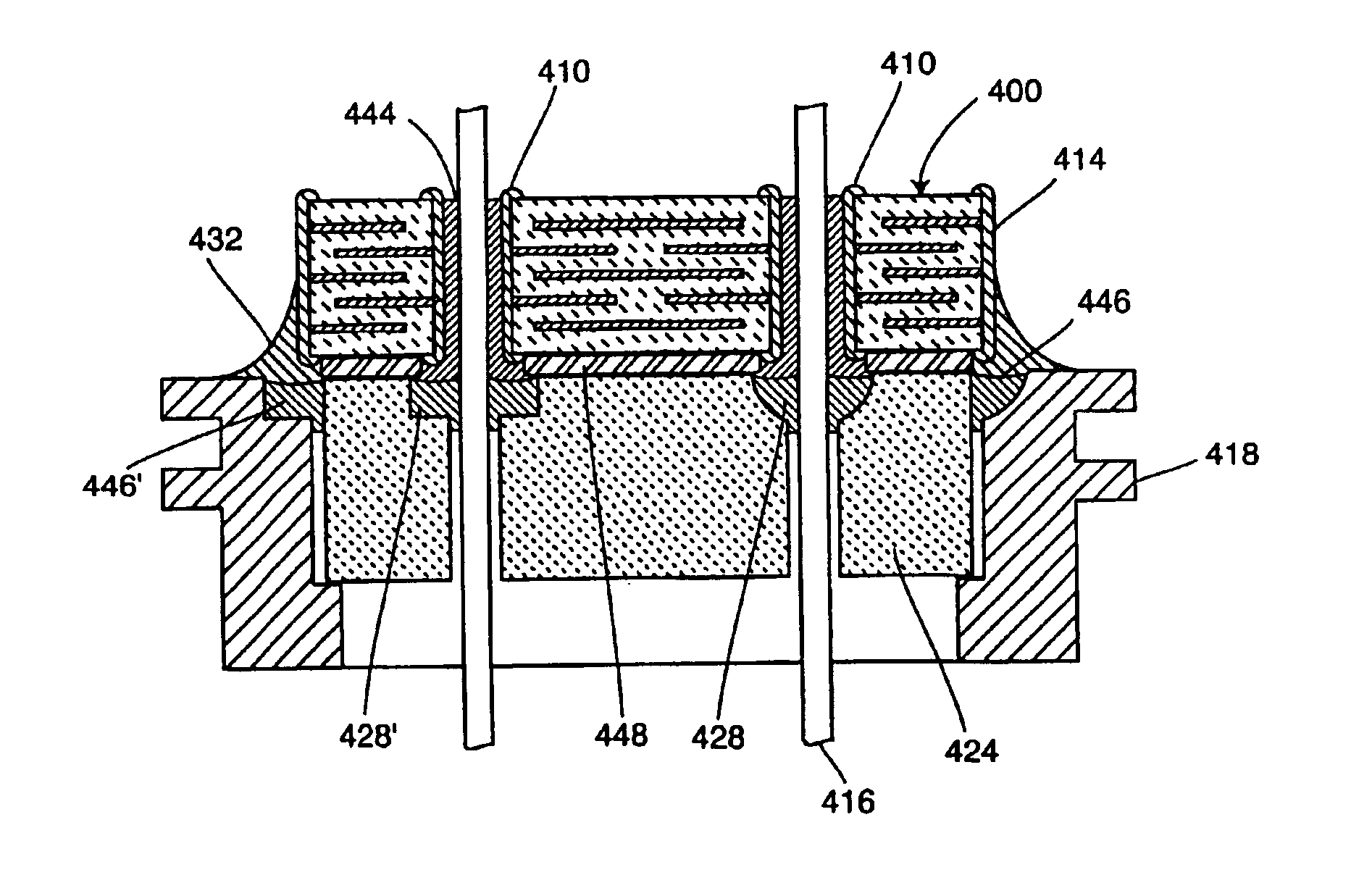 EMI feedthrough filter terminal assembly utilizing hermetic seal for electrical attachment between lead wires and capacitor