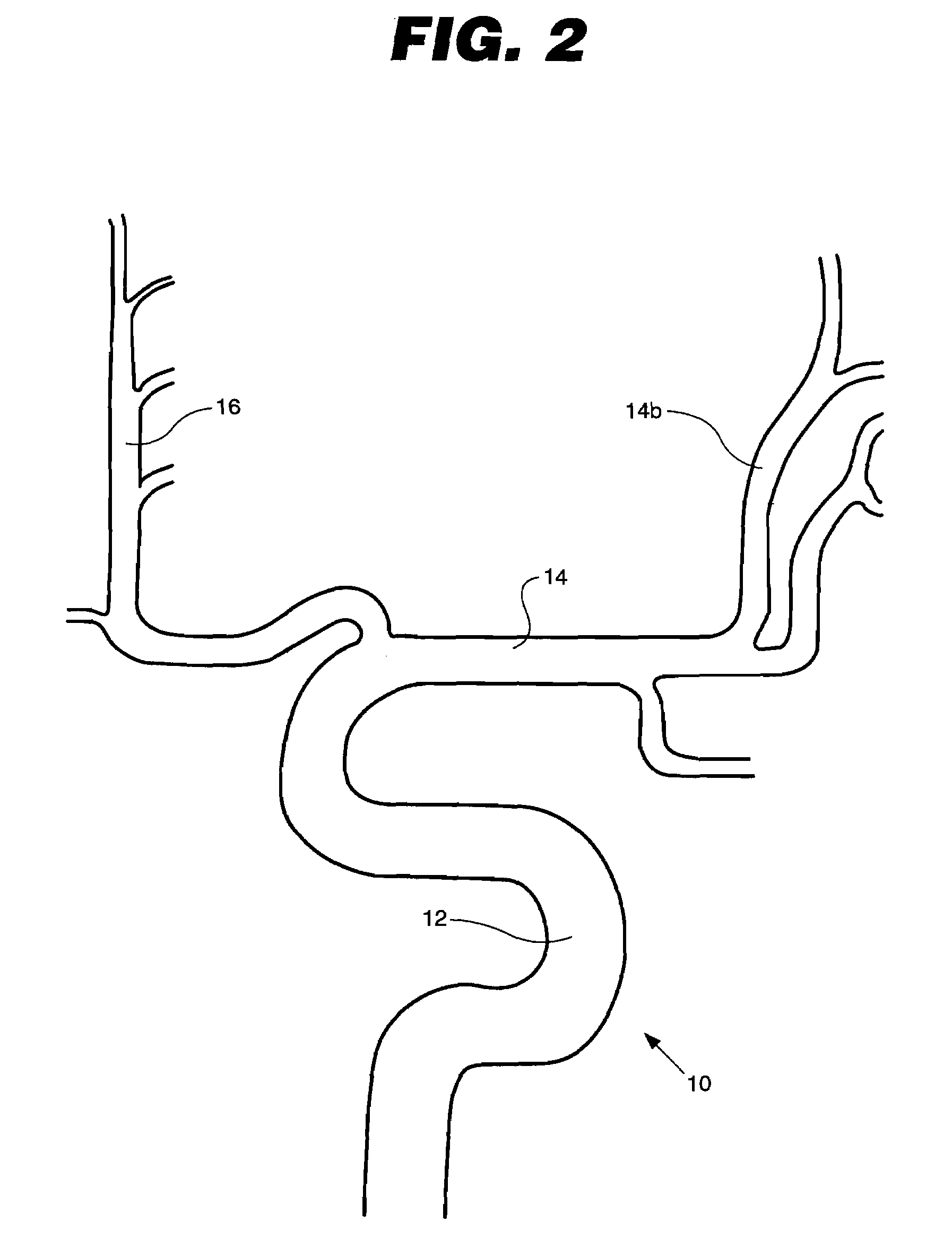 Apparatus and methods for dilating vasospasm of small intracranial arteries