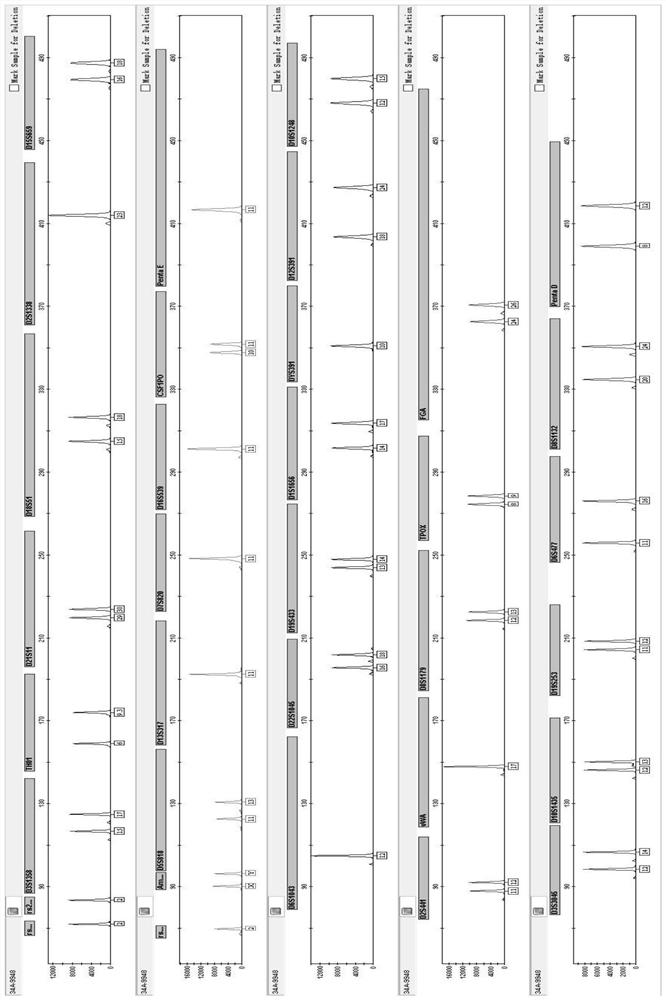 Primer group and kit for simultaneously amplifying 34 human STR gene loci and application of primer group and kit