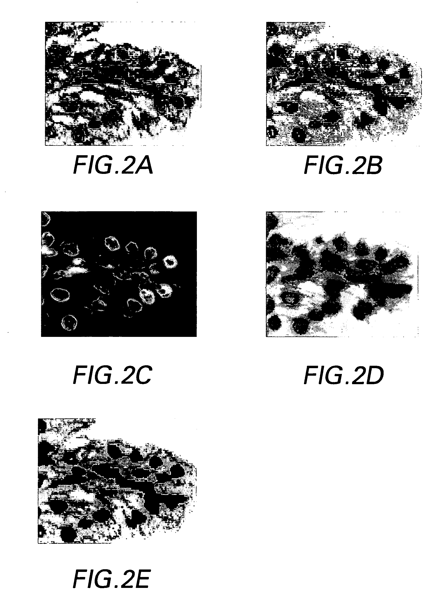 System and method for co-registering multi-channel images of a tissue micro array