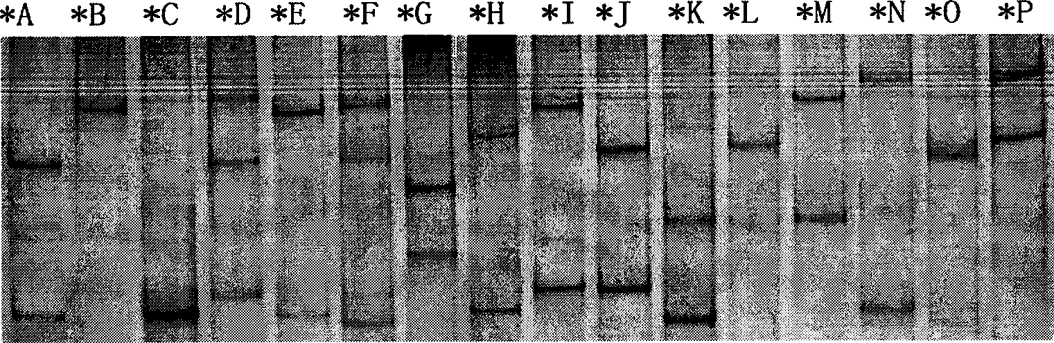 Special amplimer for detecting tibetan sheep foot rot resistance allele, detecting agent case and method thereof