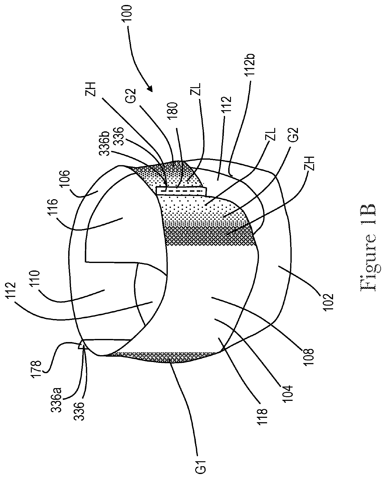 Apparatuses and methods for making absorbent articles with low intensity side seam regions