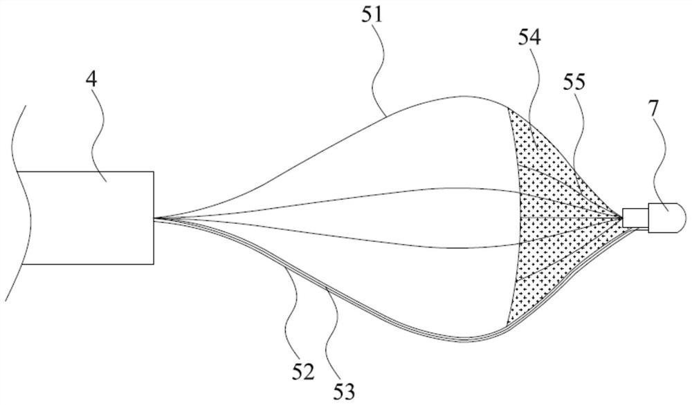 A hepatobiliary stone extraction device