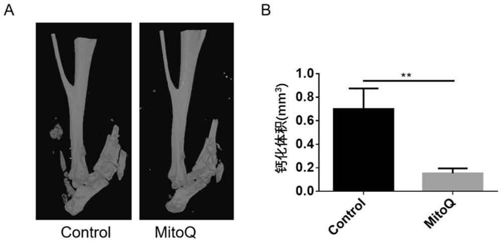 Application of mitoquinone in the preparation of medicaments for preventing and/or treating sports injuries