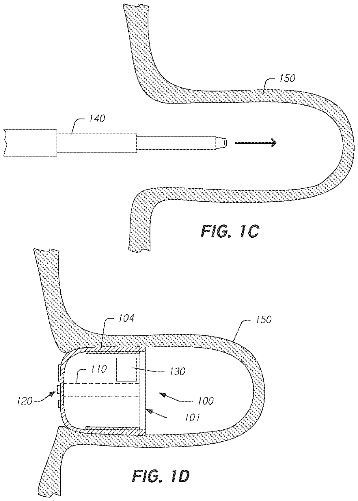 Occluder with self-powered sensors