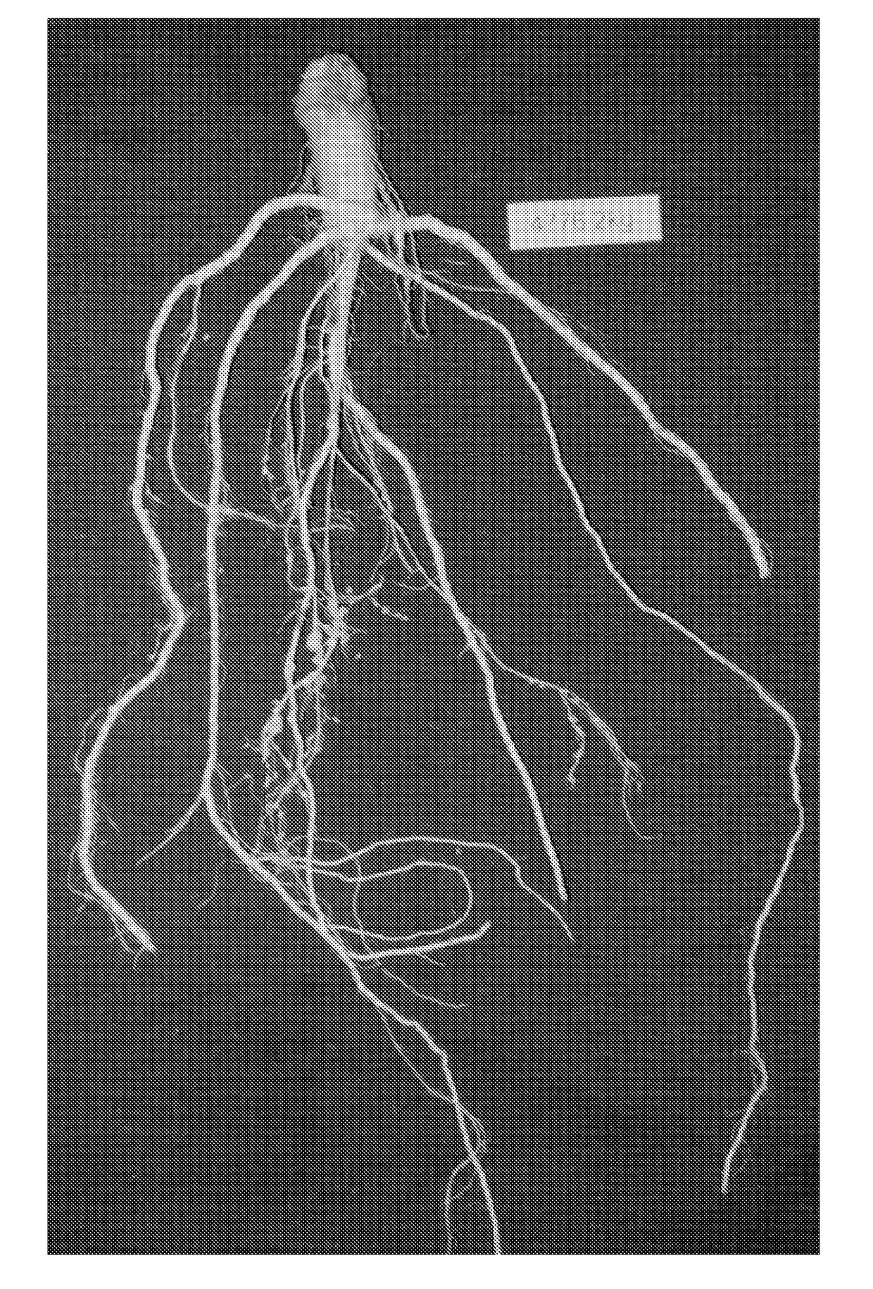 Compositions and methods for improving agronomic characteristics of plants