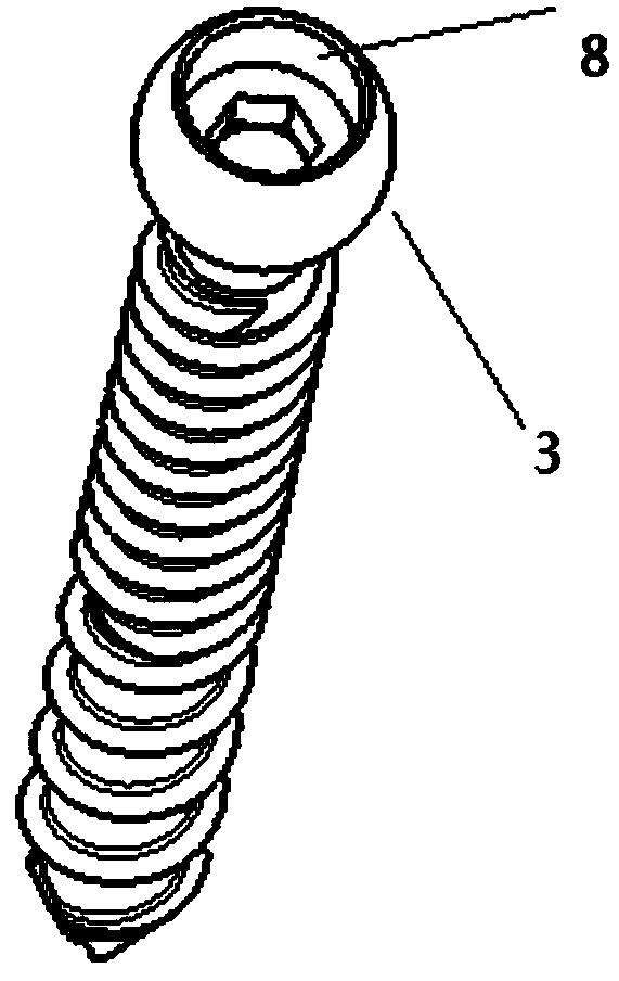 Low-profile easily-locked universal pedicle screw