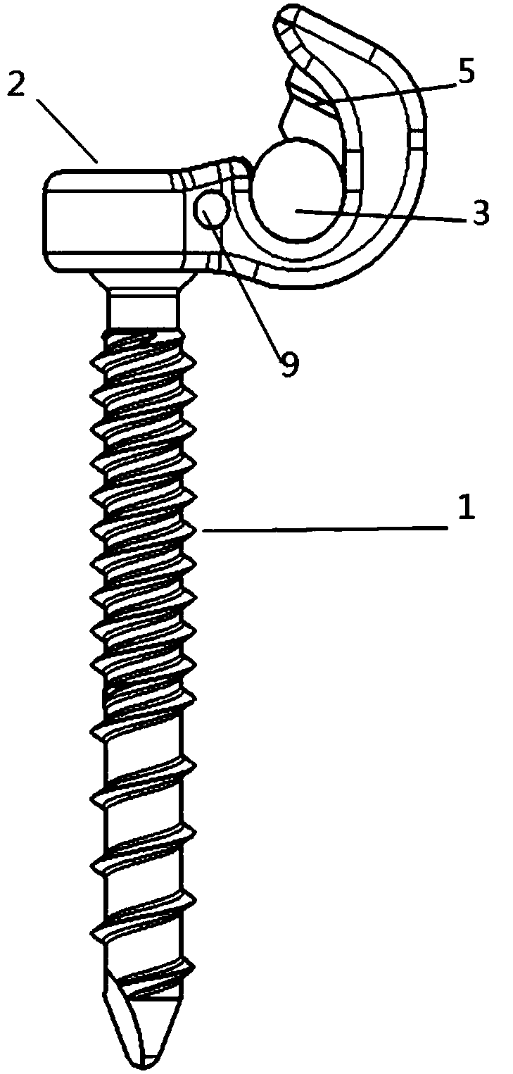 Low-profile easily-locked universal pedicle screw