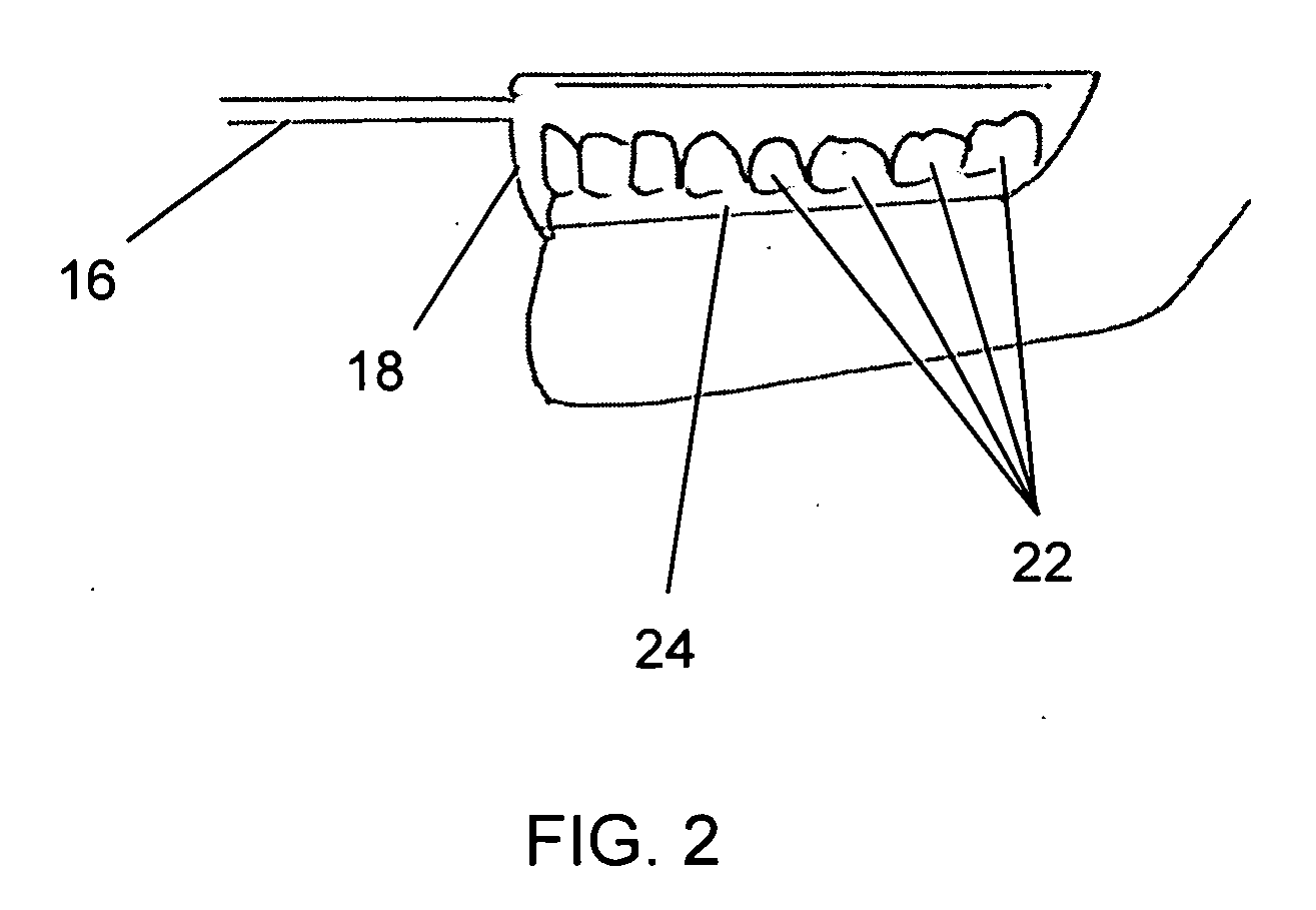 Ultrasonic Dental Treatment System