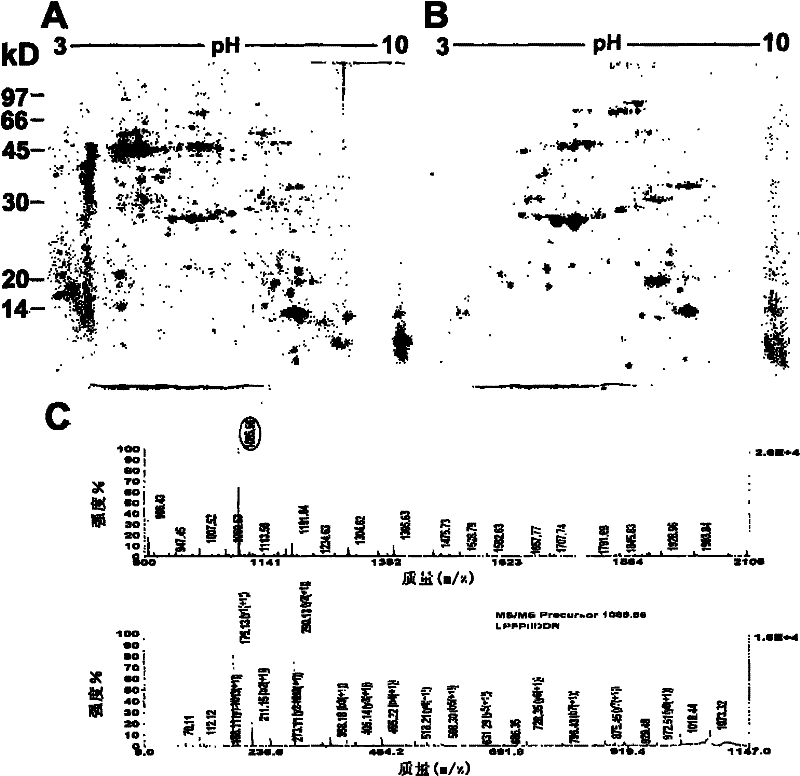 Method for detecting expression of 305 sperm localization proteins in fertility-related human testis and epididymis