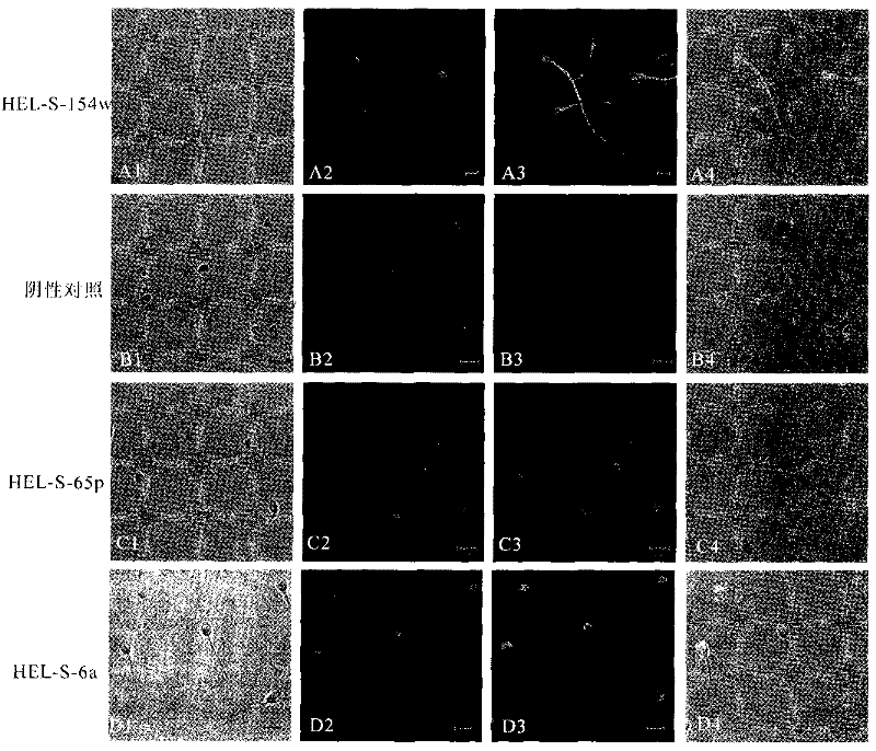 Method for detecting expression of 305 sperm localization proteins in fertility-related human testis and epididymis