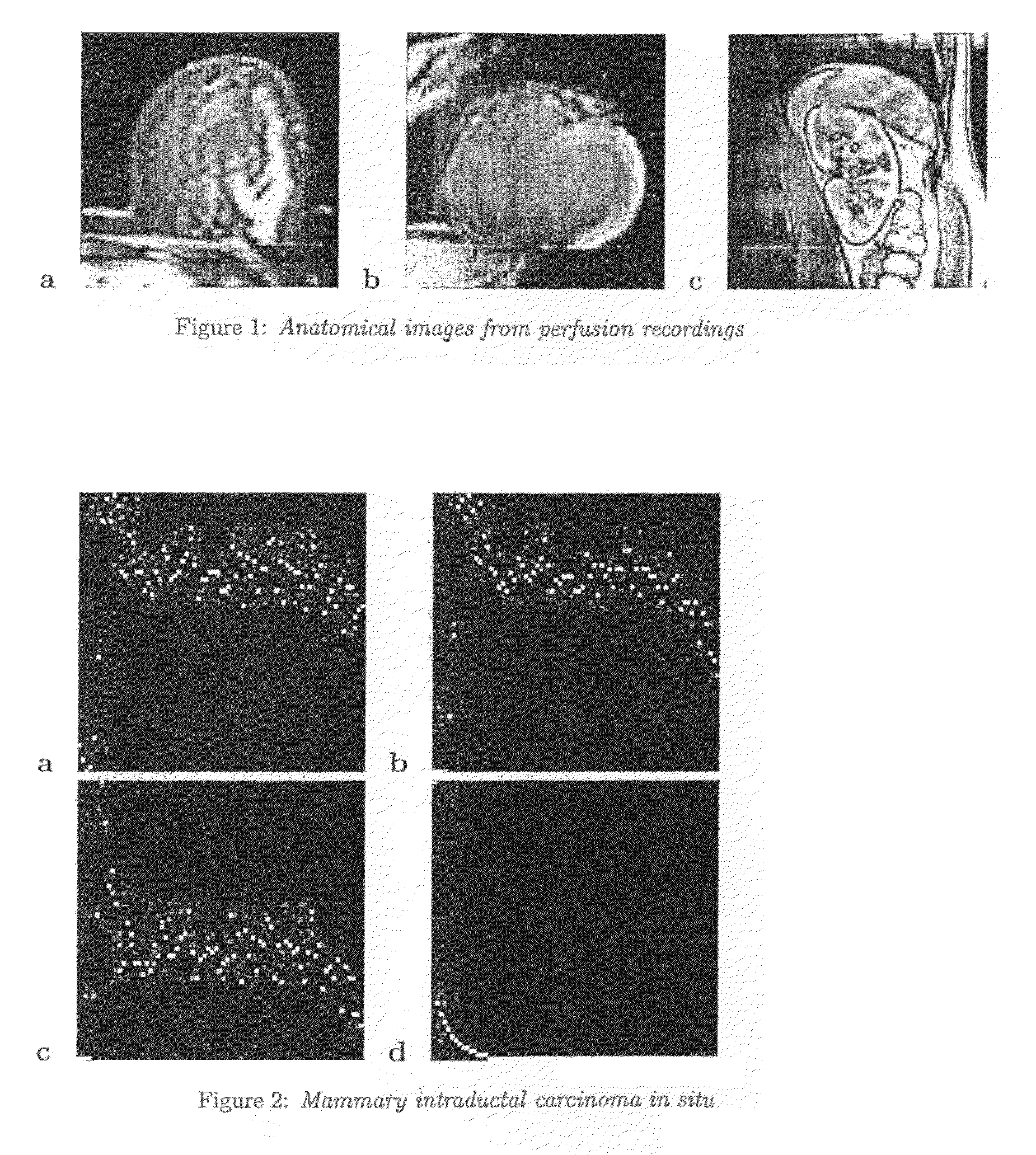 Method of generating an enhanced perfusion image