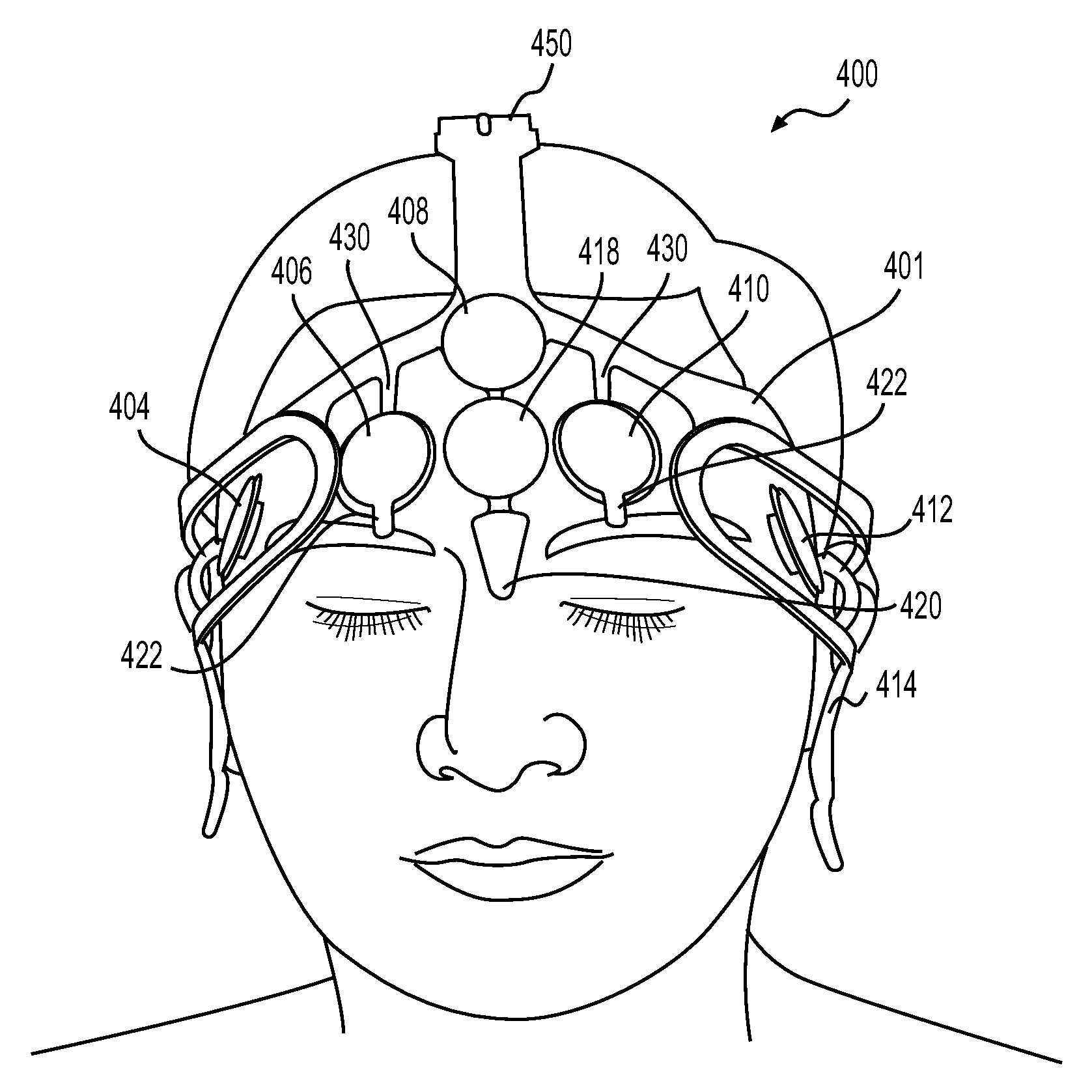 Electrode array and method of placement