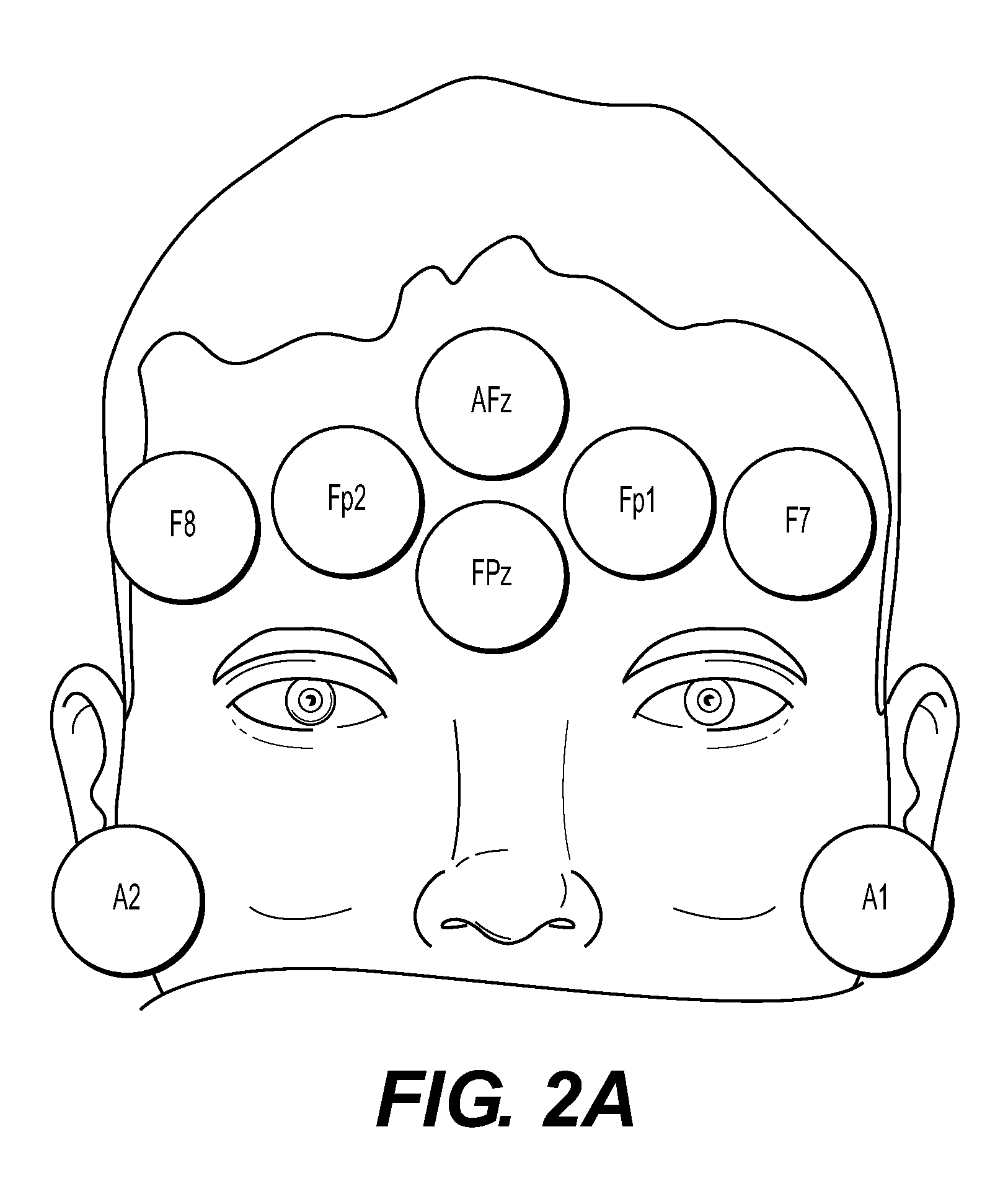 Electrode array and method of placement