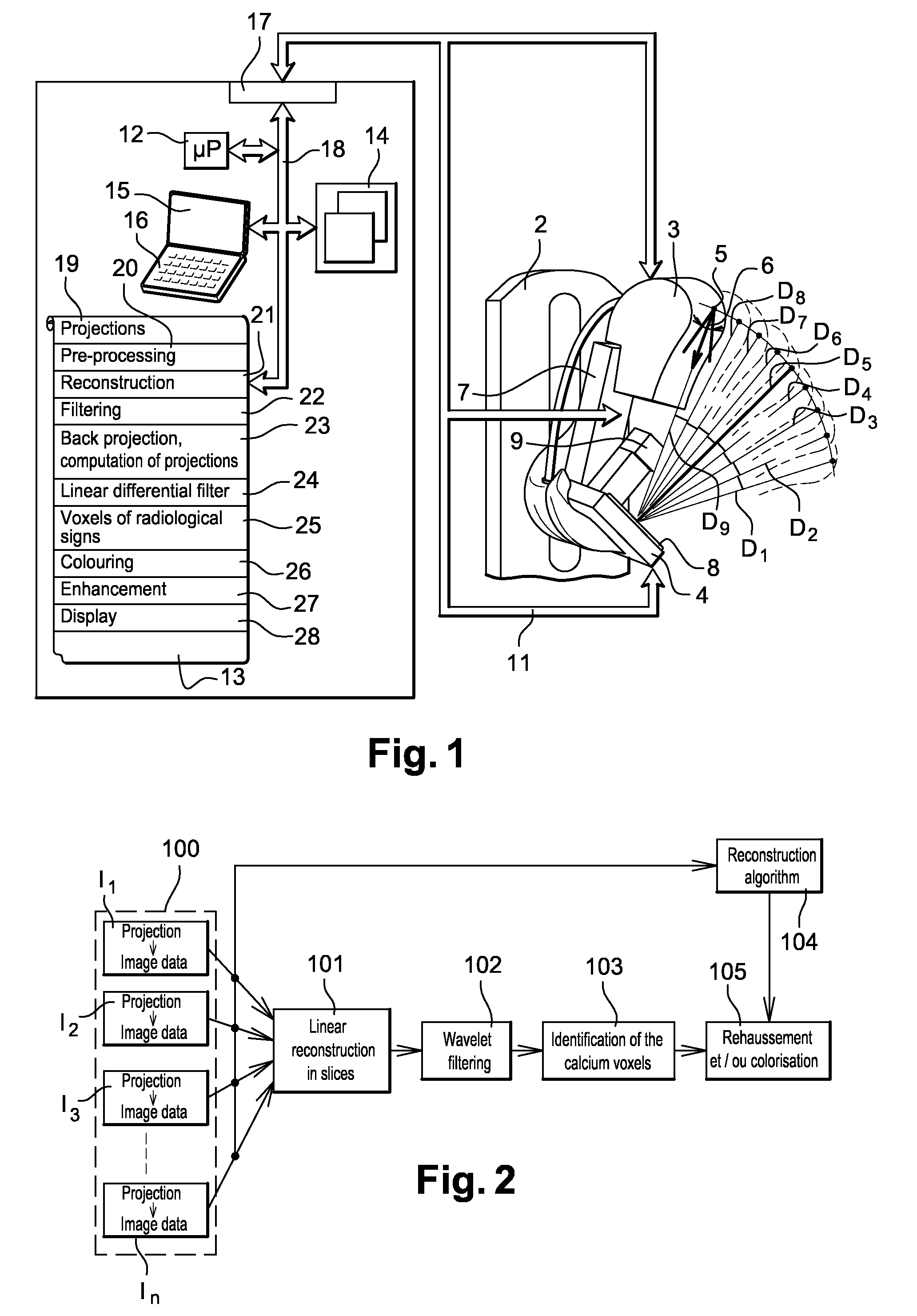 Method for the processing of radiological images in tomosynthesis for a detection of radiological signs