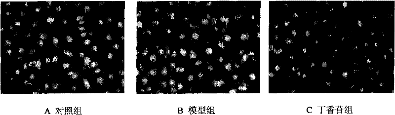 Application of syringin in preparation of medicine for treating acute gout