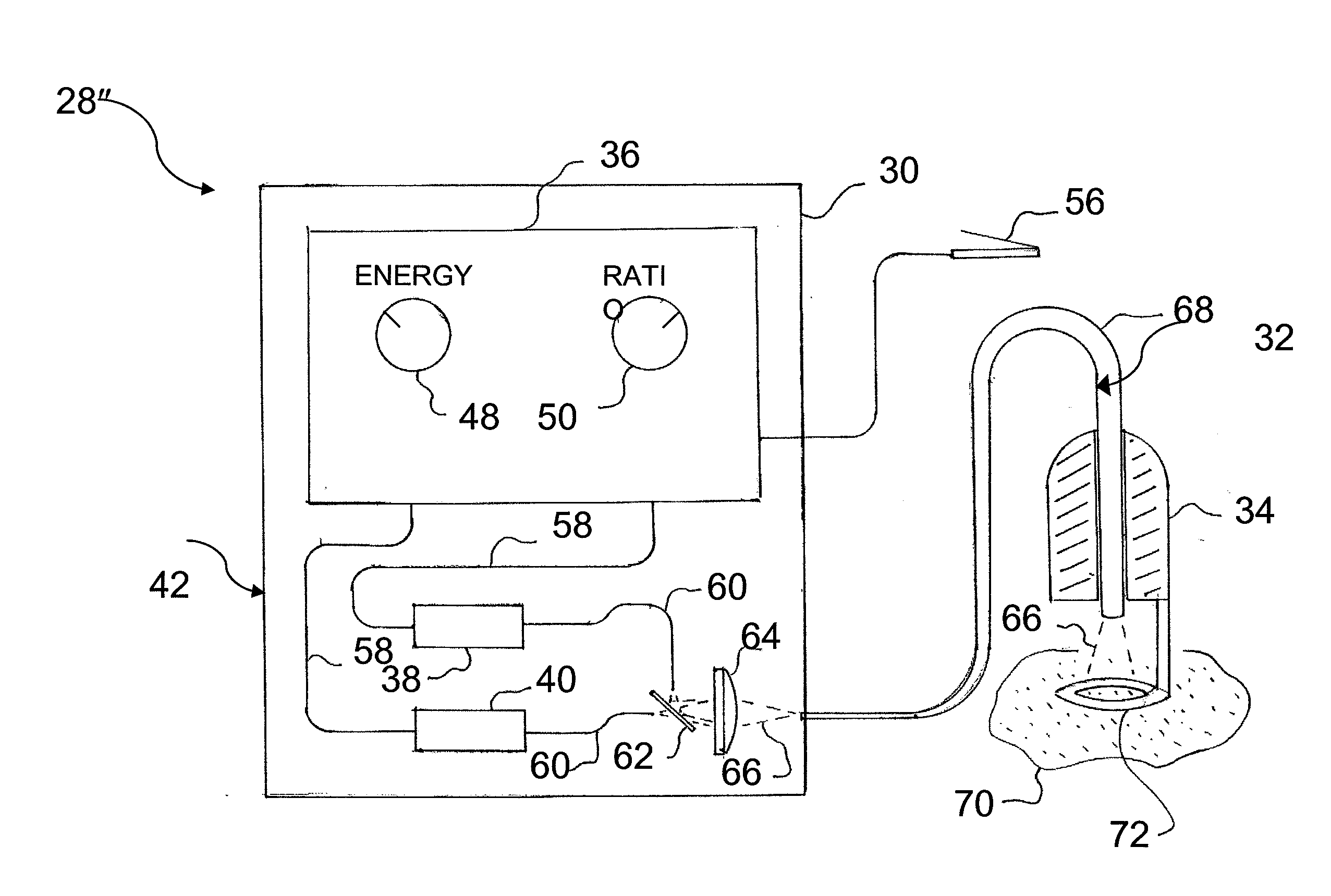 Light beam wavelength mixing for treating various dermatologic conditions