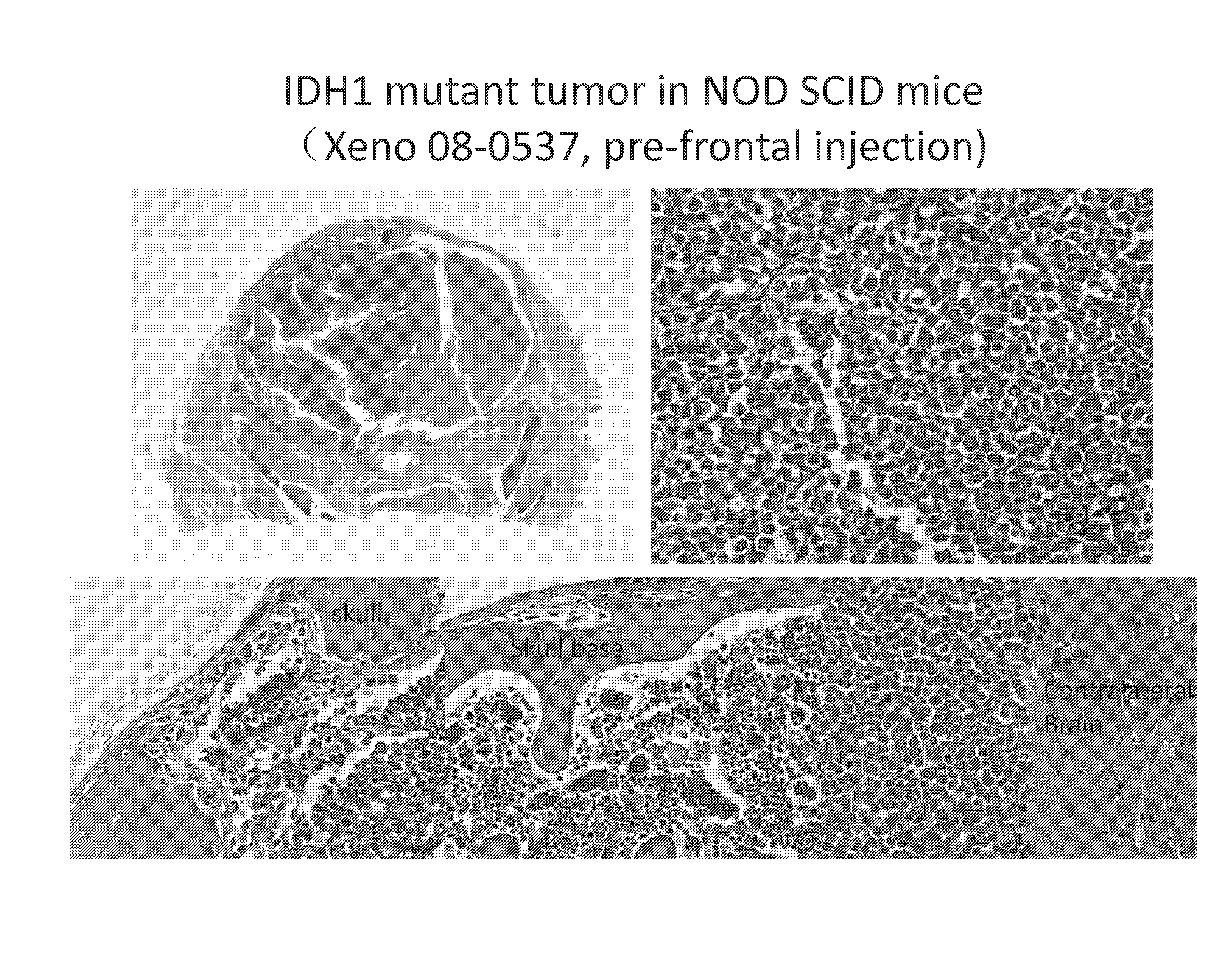 IDH1-Mutated Human Glioblastoma Cell Lines and Xenografts