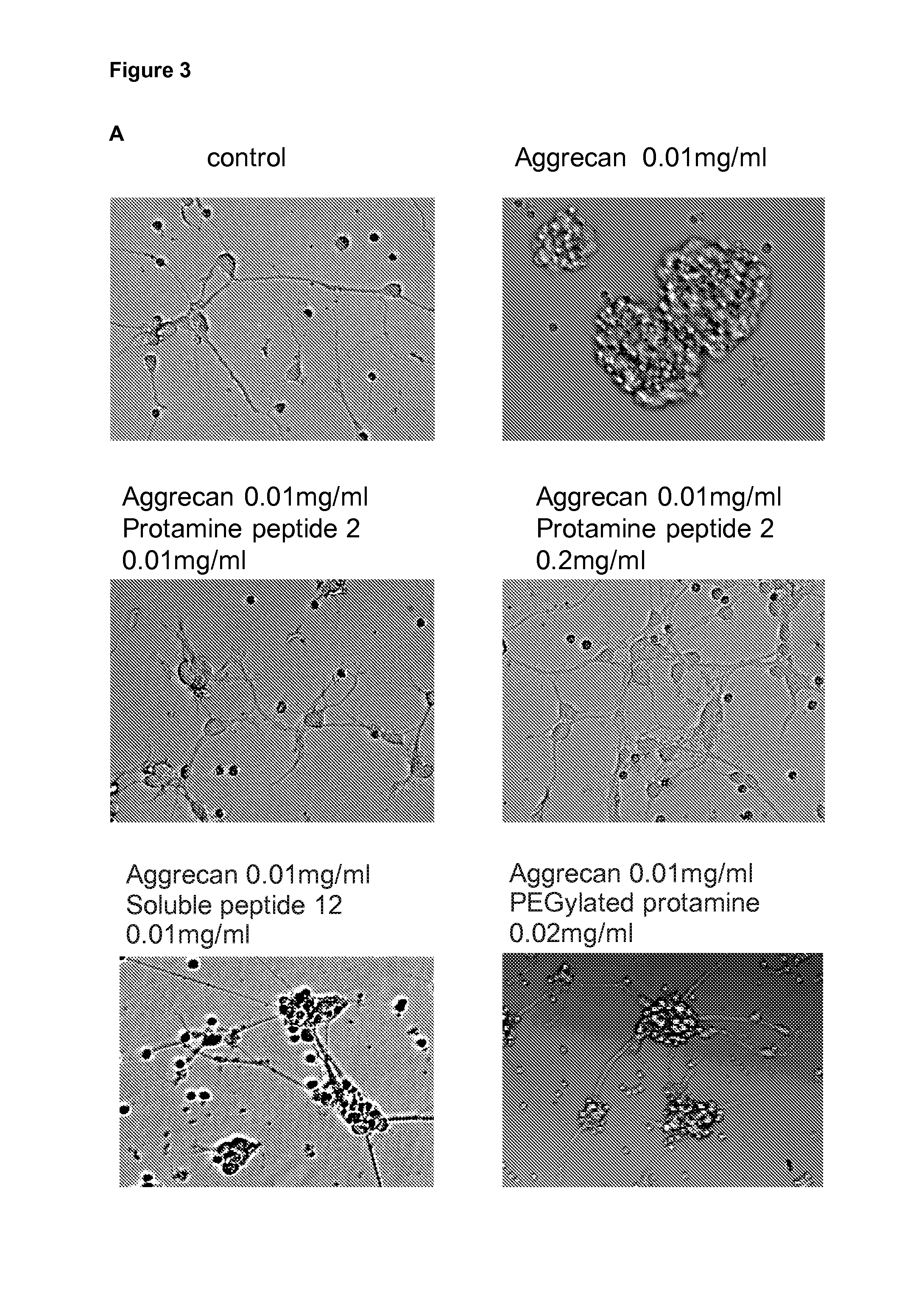 Protamine in treatment of neuronal injuries