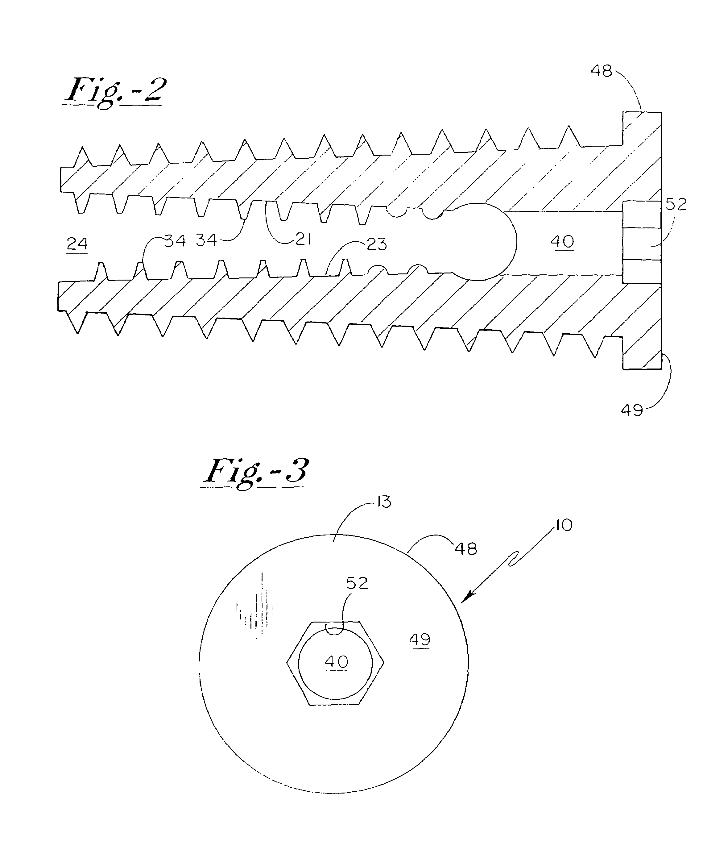 Graft anchoring device