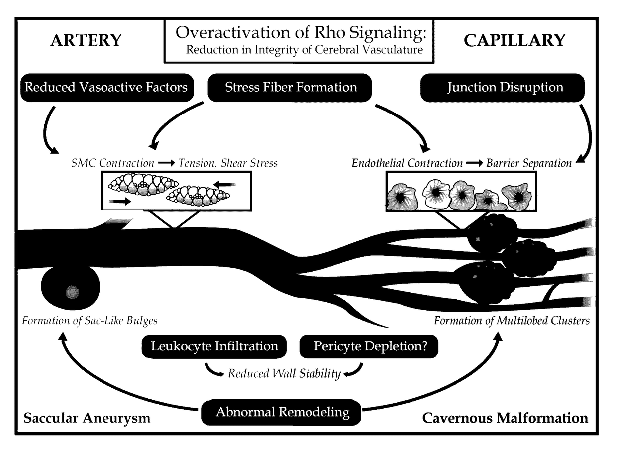 Treatment of cerebral cavernous malformations and cerebral aneurysms with Rho kinase inhibitors