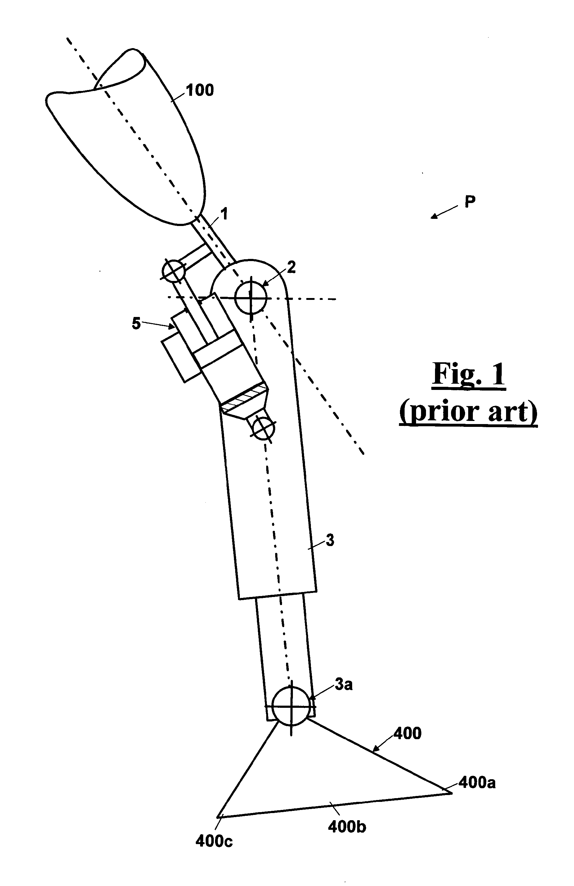 Automatic prosthesis for above-knee amputees