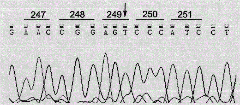 Application of RRM2B gene or protein thereof in metastasis of hepatocellular carcinoma