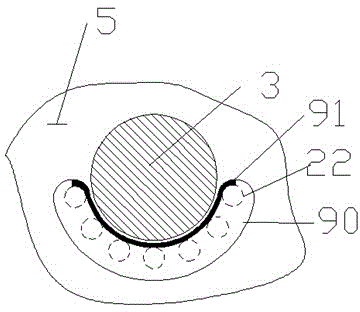 Nut protein extracting device with output tube and primary auxiliary teeth