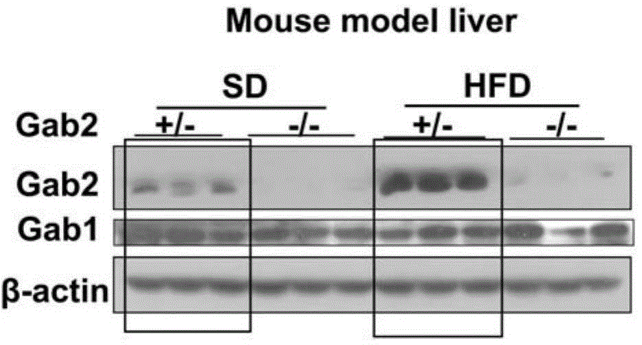 Molecular target Gab2 and application thereof in preparing medicines and health care food for preventing and treating fatty liver and liver cancer