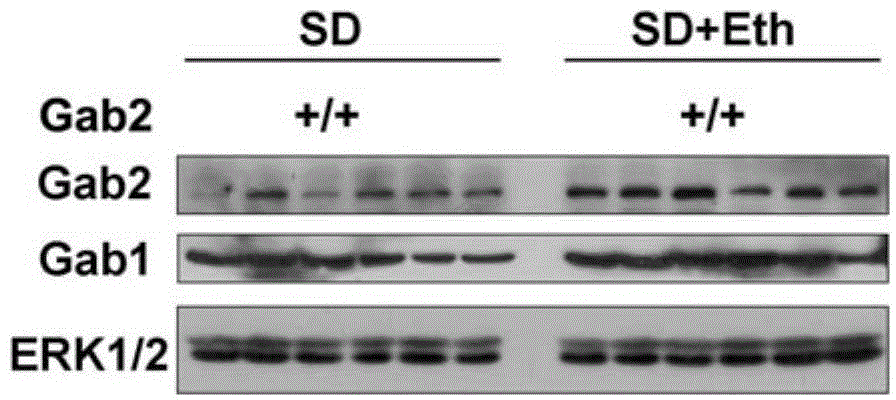 Molecular target Gab2 and application thereof in preparing medicines and health care food for preventing and treating fatty liver and liver cancer