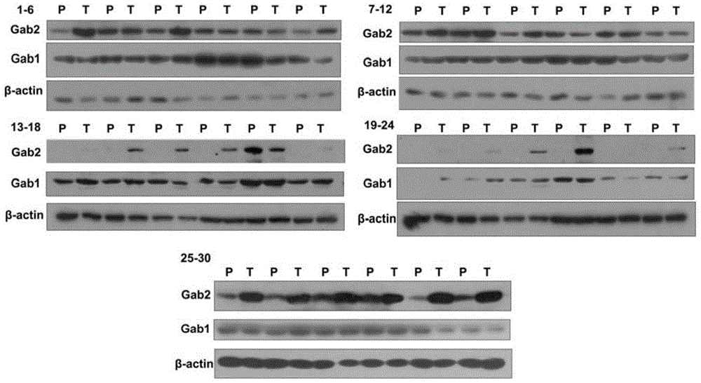 Molecular target Gab2 and application thereof in preparing medicines and health care food for preventing and treating fatty liver and liver cancer