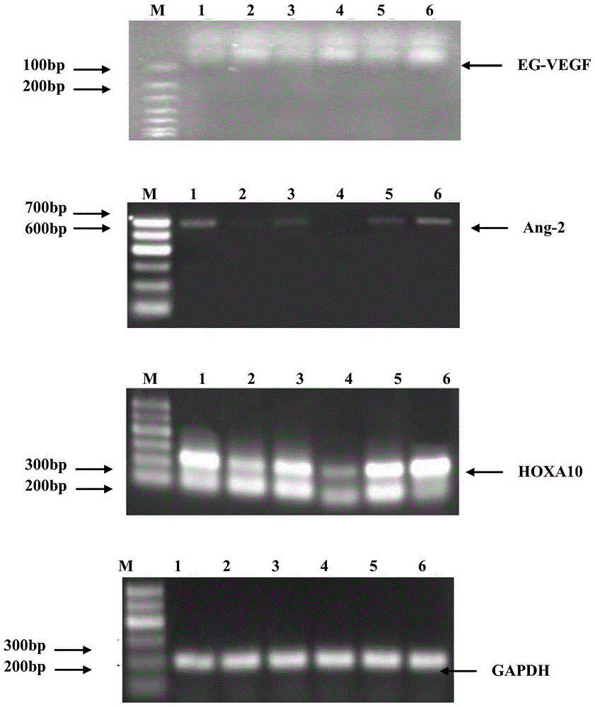 Traditional Chinese medicine composite for improving endometrium receptivity, and preparation method of traditional Chinese medicine composite