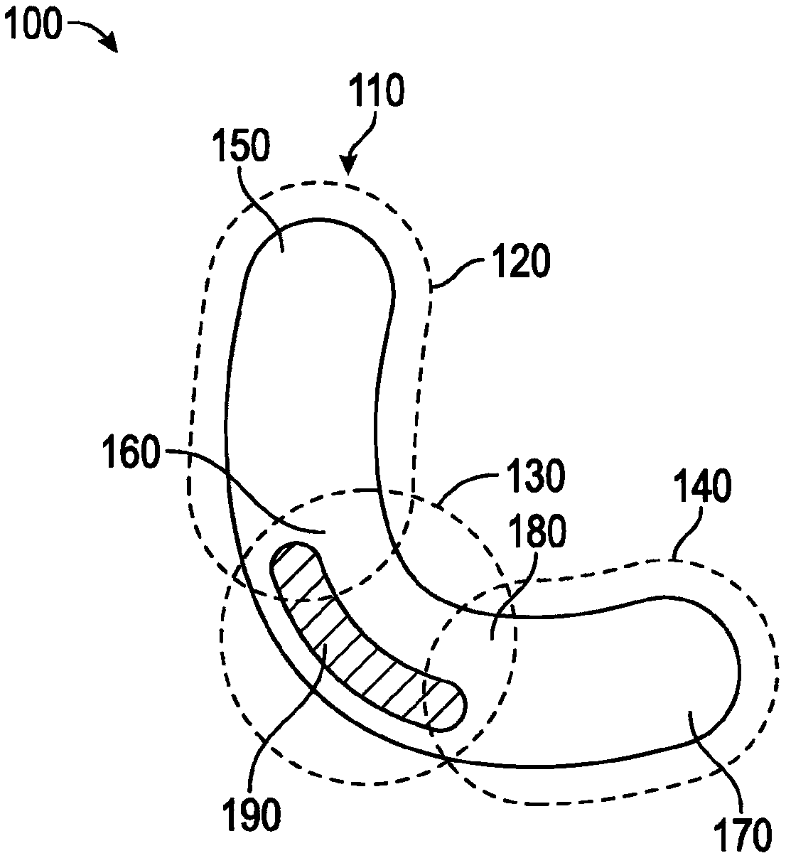 Method and apparatus for mandibular support