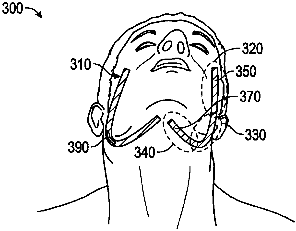 Method and apparatus for mandibular support