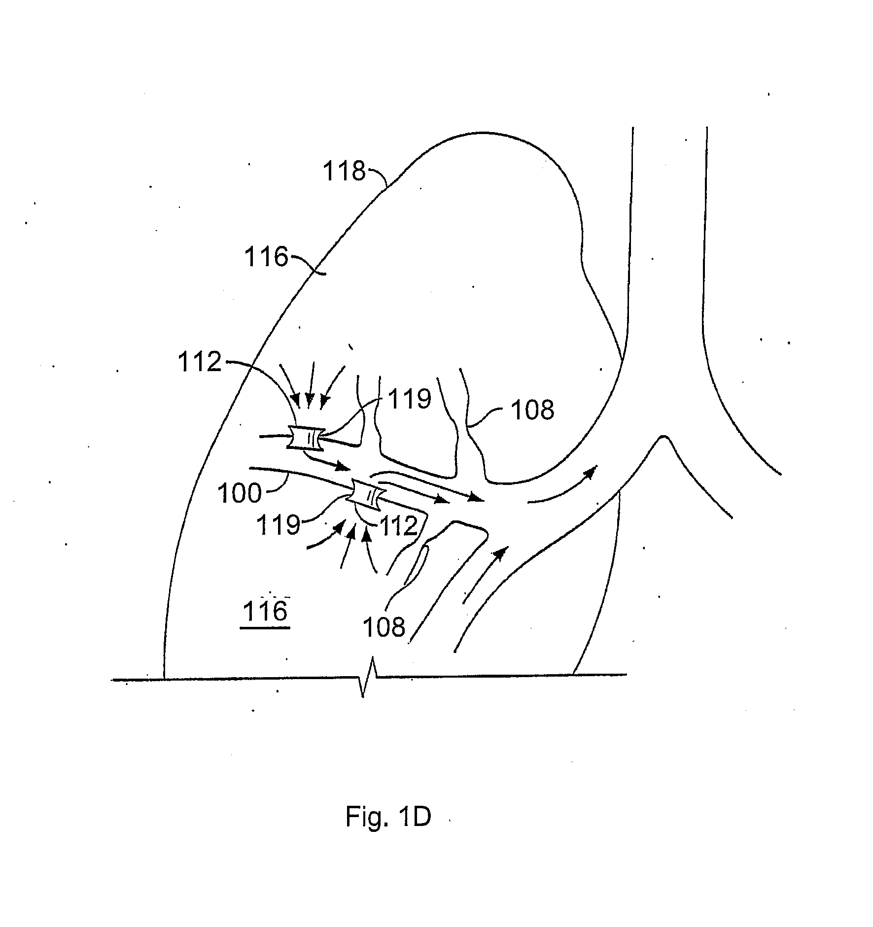 Devices for creating passages and sensing for blood vessels