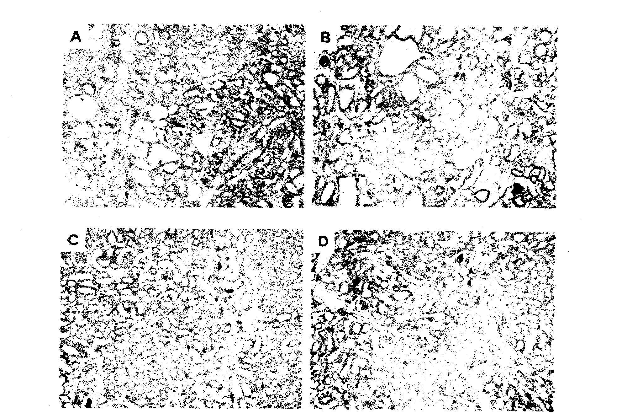 Medicine composition of rosiglitazone and amiloride and application thereof