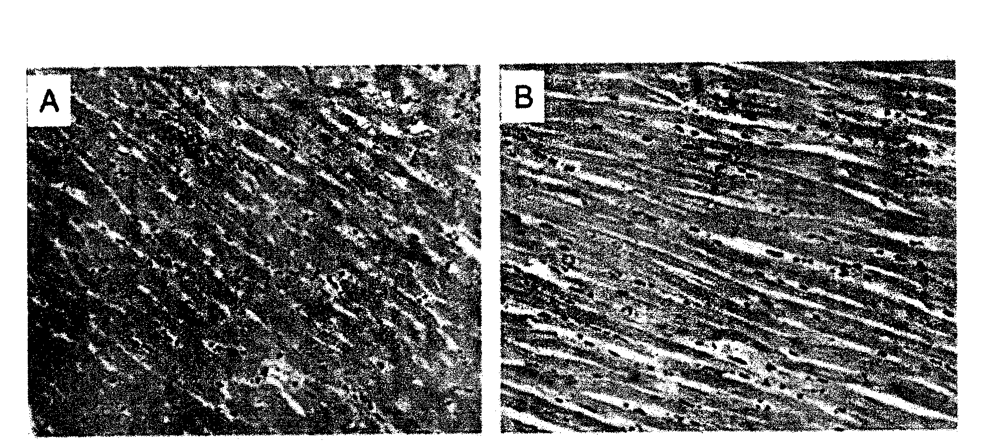 Medicine composition of rosiglitazone and amiloride and application thereof