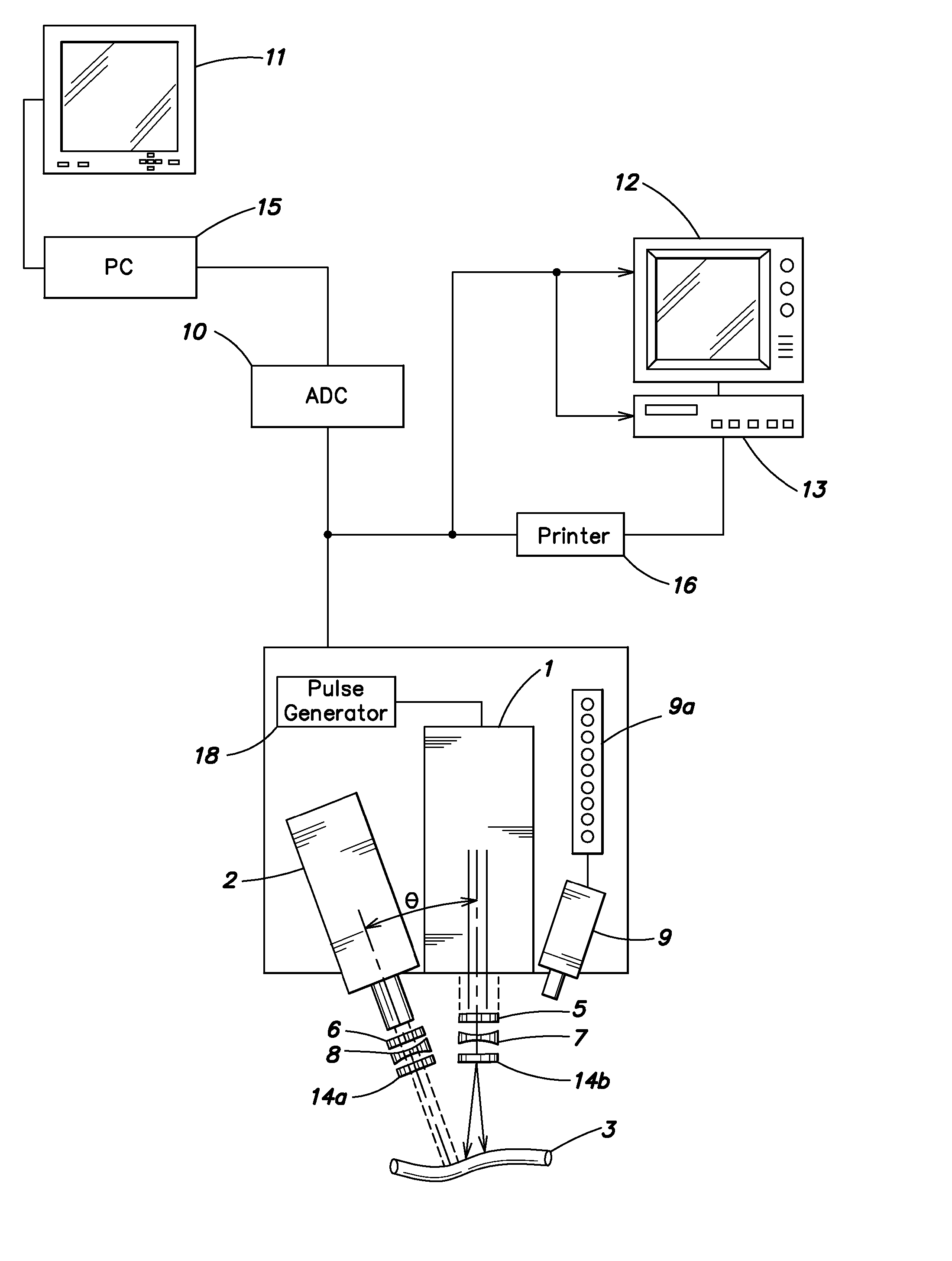 Method and apparatus for performing intra-operative angiography