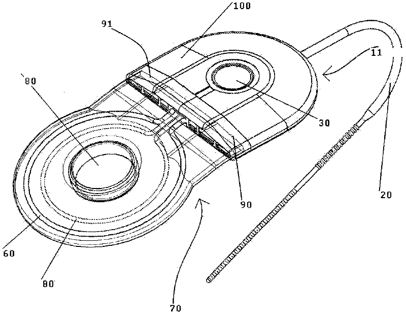 Electrical neurostimulator package