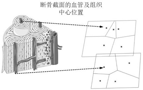 Preparation method of Thiessen polygonal bionic artificial bone structure based on broken bone surface