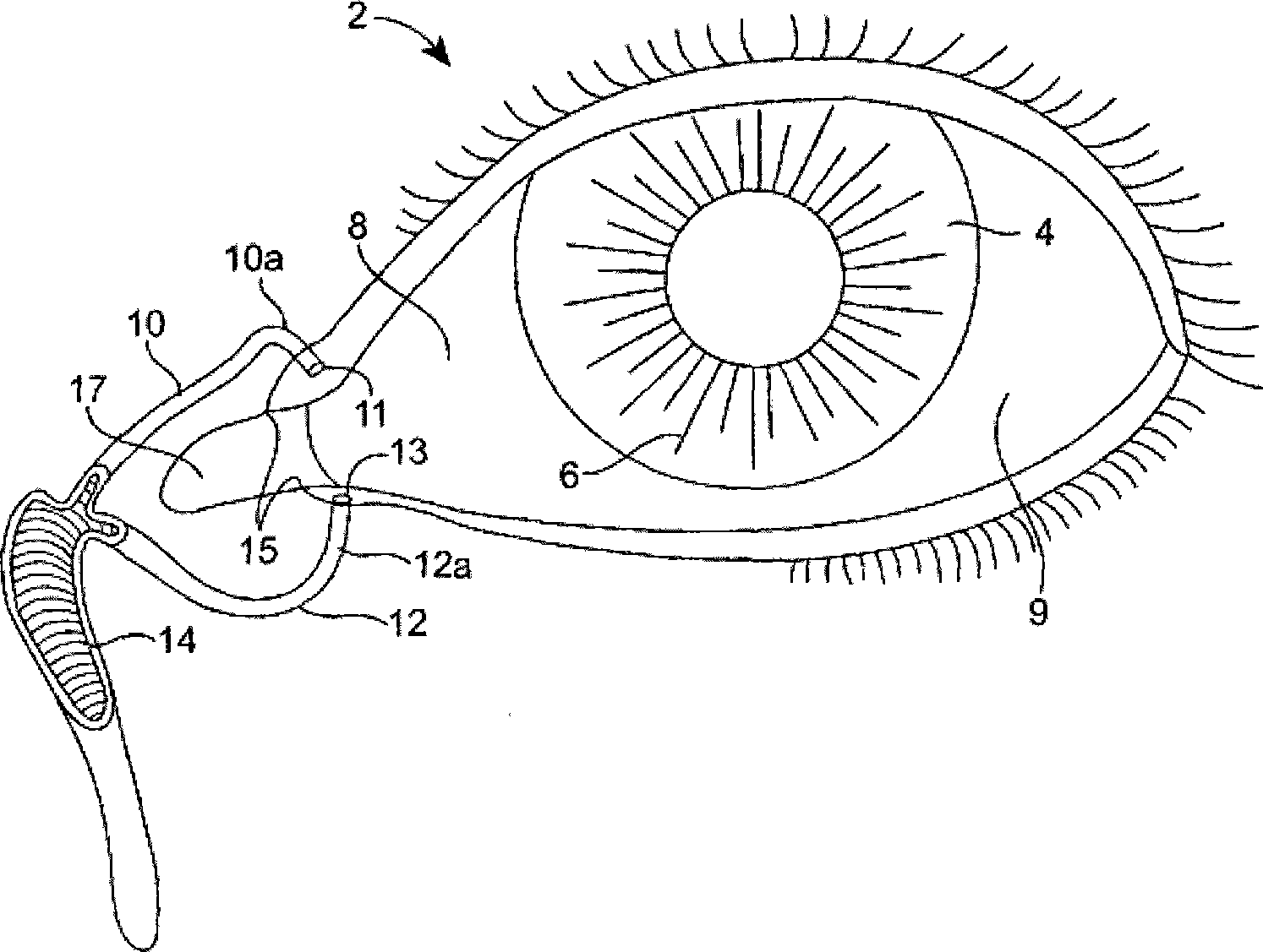 Drug delivery methods, structures, and compositions for nasolacrimal system