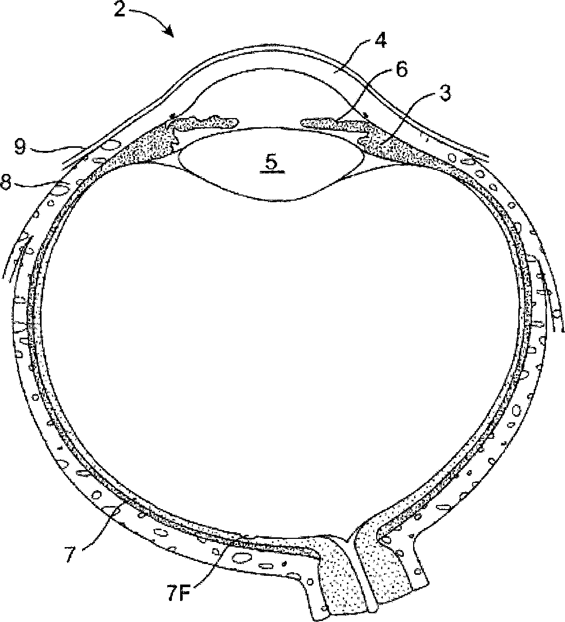 Drug delivery methods, structures, and compositions for nasolacrimal system