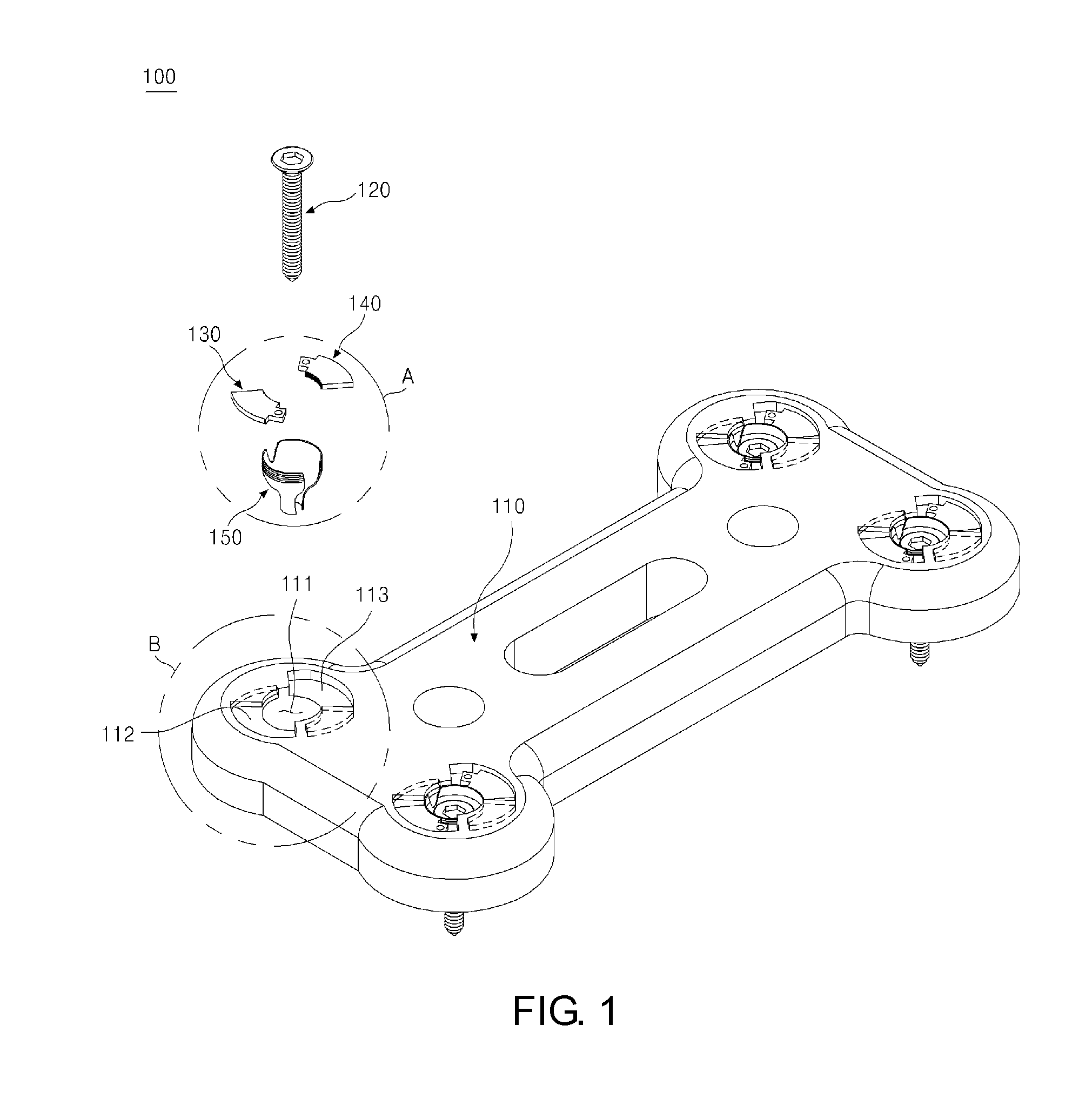 Cervical plating system