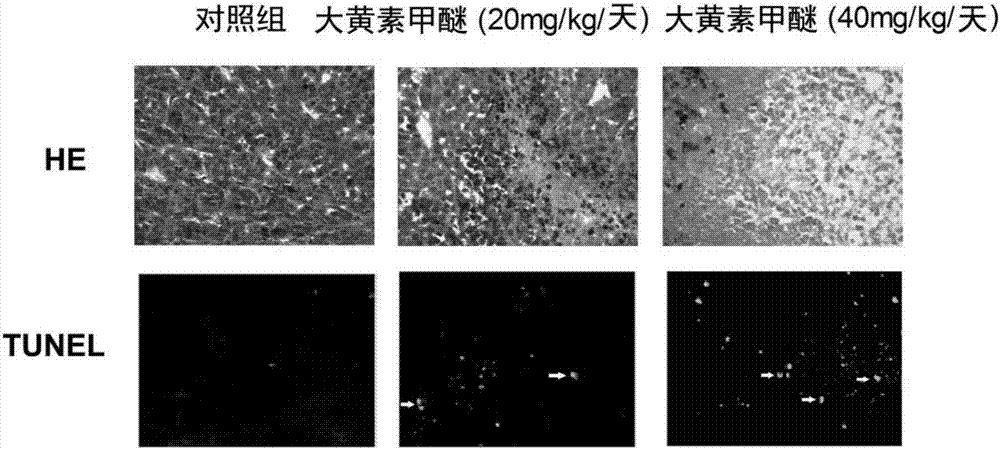 Rheochrysidin and micro-capsule of derivative of rheochrysidin as well as preparation method and application of rheochrysidin