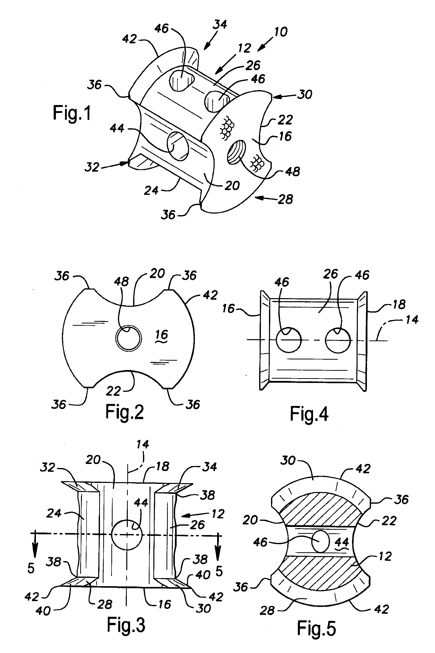 Arthrodesis of Vertebral Bodies